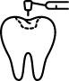 Tooth Colour Match Fillings | Lume Dental | General & Family Dentist | Red Deer